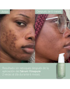 CAUDALIE VINOPURE SERUM ANTI IMPERFECCIONES 30ML