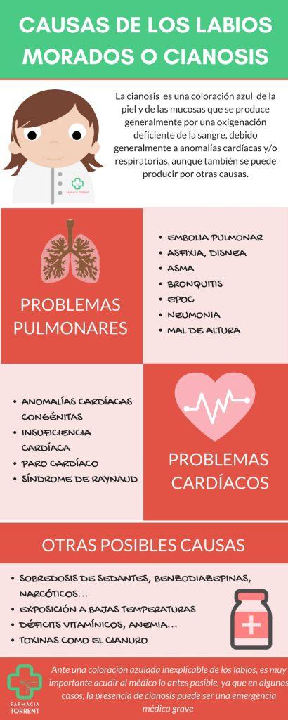Infografía causas cianosis o labios morados