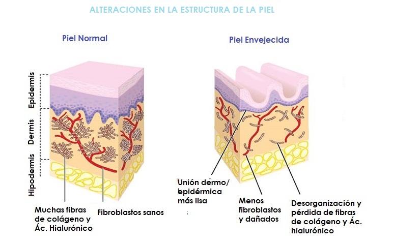 Alteraciones de colágeno en la piel