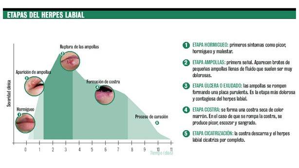 Fases Evolución Herpes Labial