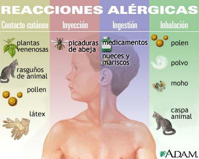 alergias