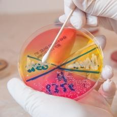 estafilococos infeccion estafilococos infeccion