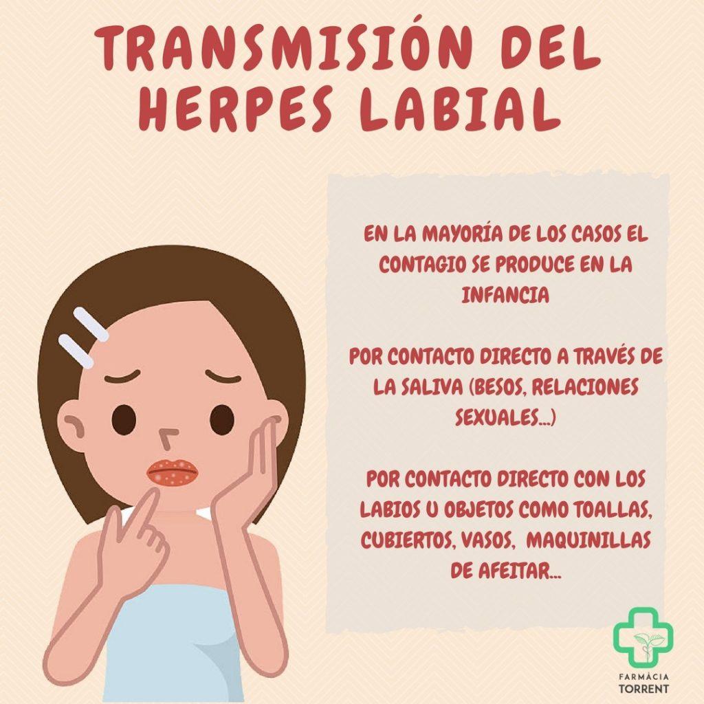 transmisión del herpes labial